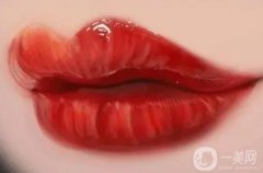 唇弓成形術(shù)有哪些方法