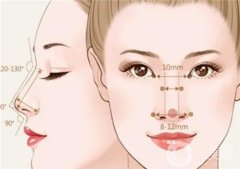 酒糟鼻整形術(shù)有沒(méi)有用?那種情況下可以做酒槽鼻整形