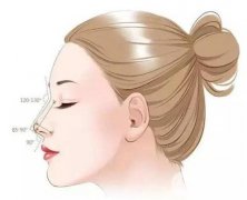 隆鼻術后產生的疤痕增生如何護理？