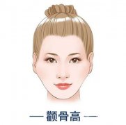 削顴骨的手術(shù)方法?