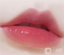 唇珠重建整形的方法？唇珠重建前的注意事項(xiàng)