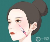 注射愛(ài)貝芙除皺的優(yōu)勢(shì)？