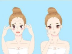 適合與不適合電波拉皮的人？