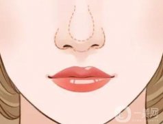 耳軟骨墊鼻尖是不是*性的？