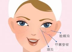 膠原蛋白填充淚溝果好不好？填充前后需要注意什么