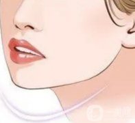 下頜角切骨后需要戴頭套多長時間？