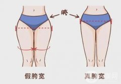 假胯寬可以減掉嗎？具體都有哪些方法呢？