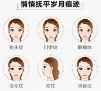 電波拉皮是什么？作用與價格？