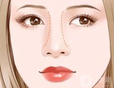 硅膠隆鼻術(shù)后如何護(hù)理才能夠保持*的果？