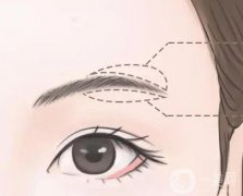 切眉有什么作用和副作用？