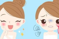 祛痣有什么風(fēng)險嗎？哪種祛痣方法好？
