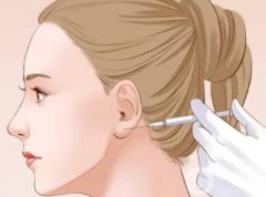 影響玻尿酸豐耳垂價(jià)格的因素？果如何呢？