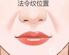 用脂肪填充法令紋能管多久？果如何？