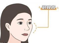 降低顴弓和顴骨內(nèi)推有什么不同？