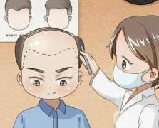 種植發(fā)際線的價(jià)格是多少?