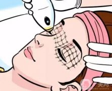 做熱瑪吉導(dǎo)致臉凹陷的原因是什么？