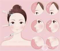 脂肪填充大的腫脹是哪一天？