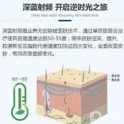 深藍(lán)射頻果能持續(xù)多久？副作用是什么？