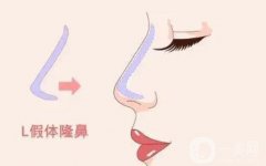 隆鼻假體取出的必要條件是什么？需要注意什么？