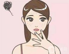 哪些斑適合激光調節(jié)？怎么選擇不同的激光調節(jié)？