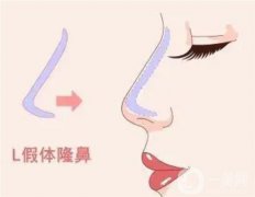 隆鼻假體取出是不是會很痛？恢復(fù)過程是怎么樣的？