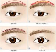 什么情況需要切眉？會留疤嗎？