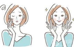 的好處和壞處是什么？激光祛斑會反彈嗎？