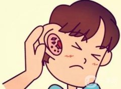 生物支架再造耳有哪些優(yōu)勢(shì)