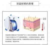 深藍射頻除皺有什么優(yōu)點？哪些因素決定深藍射頻除皺的價格