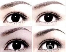 激光洗眉會(huì)出血嗎？洗眉毛不出血的激光儀有哪些？