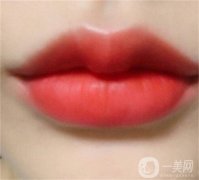 怎么讓嘴唇變得豐滿？豐唇手術有哪些禁忌？