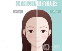 果酸換膚的果可以維持多久？有哪些癥狀適用于果酸換膚？