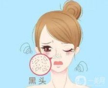 果酸換膚去黑頭的果怎么樣呢？有哪些醫(yī)美項(xiàng)目可以改良黑頭？