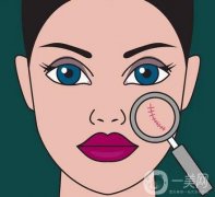 調(diào)節(jié)手術(shù)疤痕有什么好方法？