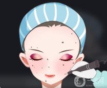 激光點痣后不能吃什么？可以吃辣椒嗎？