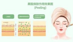 果酸換膚前后需要注意什么？這幾點(diǎn)一定要注意