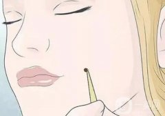 激光點(diǎn)痣后的凹洞如何護(hù)理？激光點(diǎn)痣后要忌口多久？