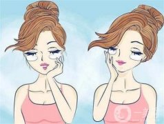 什么因素影響去除眼袋的價(jià)格？去眼袋的誤區(qū)有哪些？