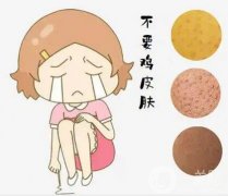 雞皮可以用激光去除嗎？具體有哪些注意事項(xiàng)呢？