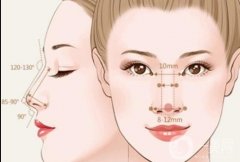 墊鼻基底多久能恢復(fù)自然？恢復(fù)期的注意事項(xiàng)？