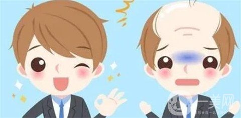 人工頭發(fā)種植*果嗎？