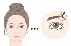 切眉的禁忌與注意事項(xiàng)？