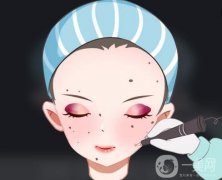 如何護(hù)理激光點(diǎn)痣后的凹洞？激光點(diǎn)痣后要忌口多久？