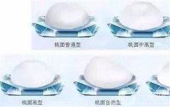 隆胸假體取出來(lái)后胸部會(huì)是什么樣的？