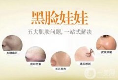 黑臉娃娃激光美容術(shù)前術(shù)后注意事項有哪些？