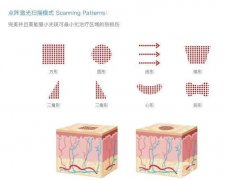 哪些情況可以做點陣激光？