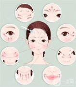 哪些皺紋可以手術(shù)去除？具體有哪些呢？