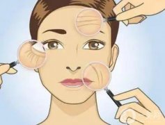 深藍射頻是什么果？術(shù)前準備？