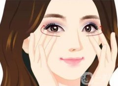 去眼袋是怎么做的？有哪些優(yōu)勢和劣勢？