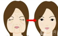 熱瑪吉緊膚價格貴不貴？有哪些因素會影響到價格？這些注意事項需知